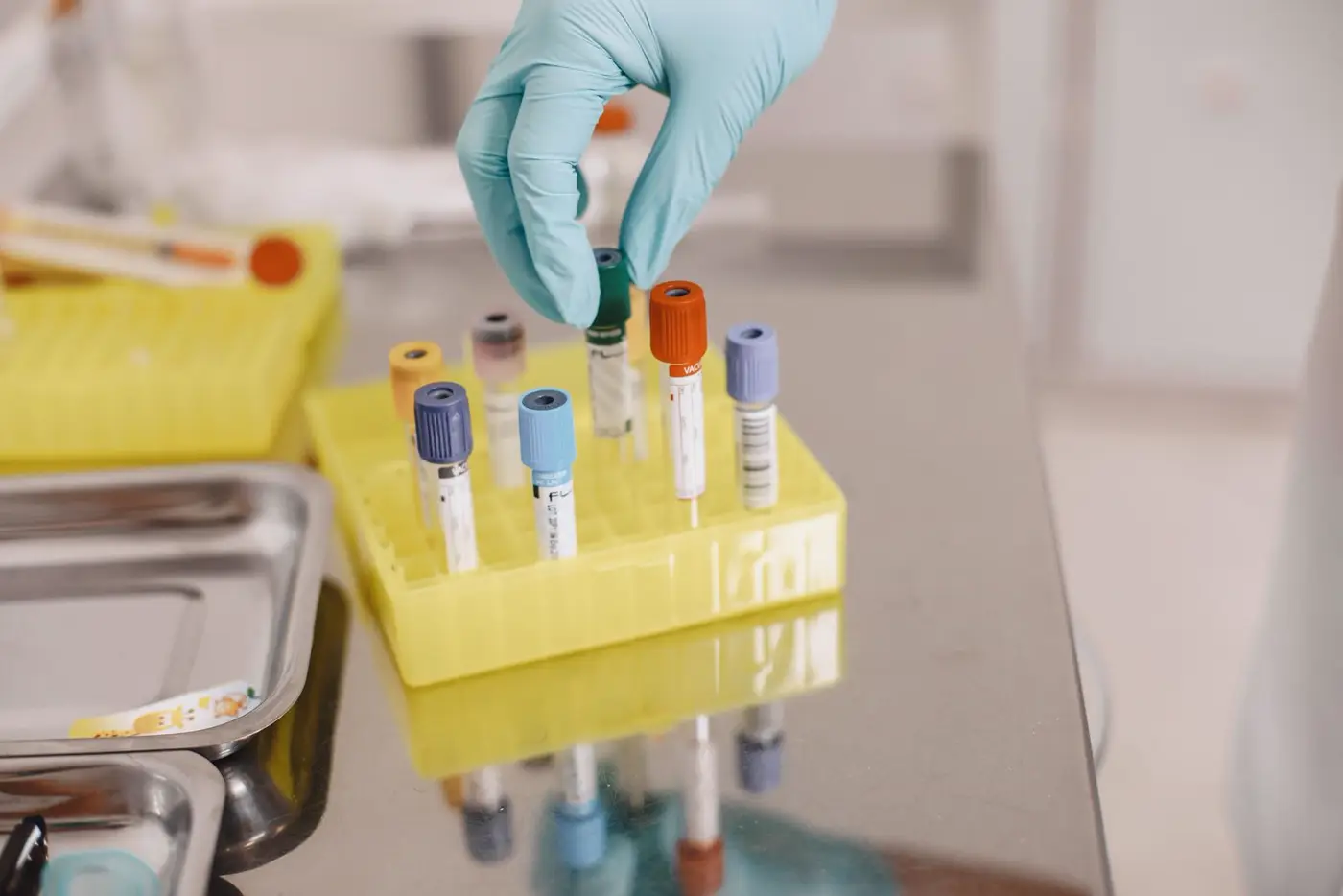 Tubos de coleta de exame de sangue em laboratório