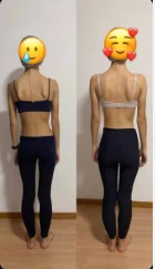 Antes e depois de postura, vista de costas