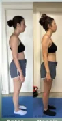 Antes e depois de postura, vista de perfil